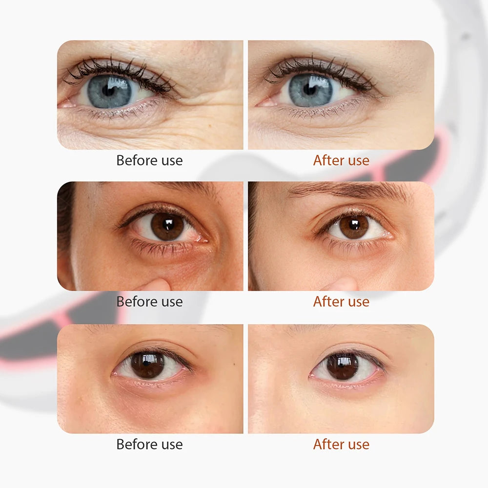 LumiEye™ – Okulary do Terapii Czerwonym Światłem | EMS + Red Light